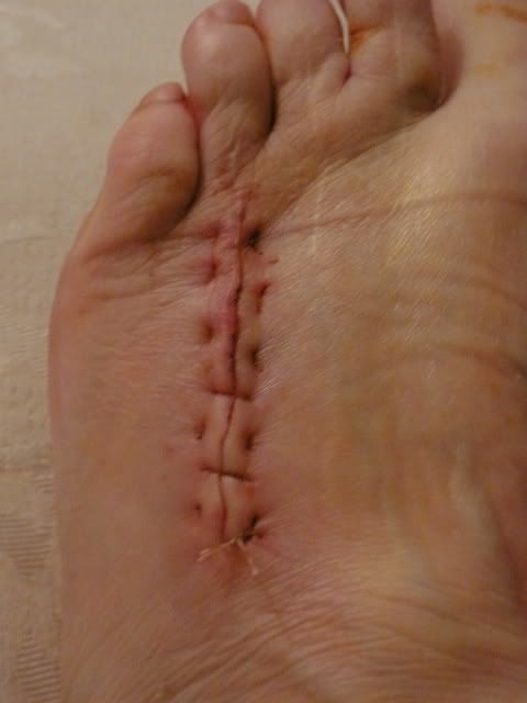 http://i277.photobucket.com/albums/kk41/LzzieIzzie/P1040879.jpg