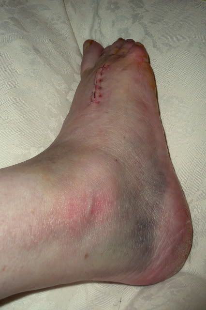 http://i277.photobucket.com/albums/kk41/LzzieIzzie/P1040890.jpg