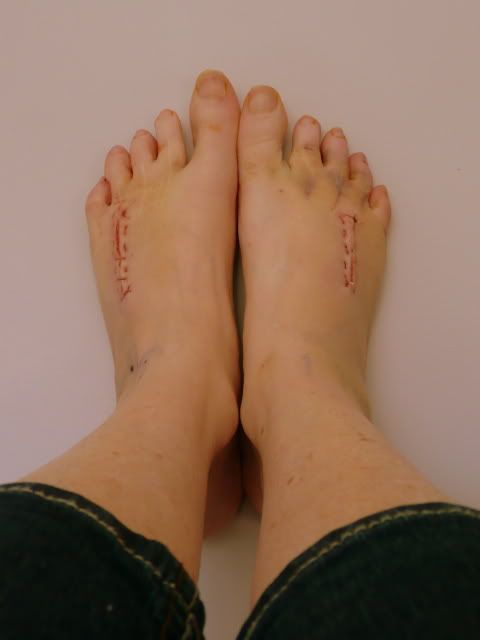 http://i277.photobucket.com/albums/kk41/LzzieIzzie/whatever/P1040932.jpg