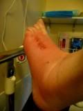 http://i277.photobucket.com/albums/kk41/LzzieIzzie/whatever/P1050053.jpg