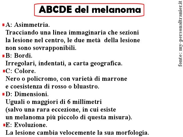 abcde melanoma