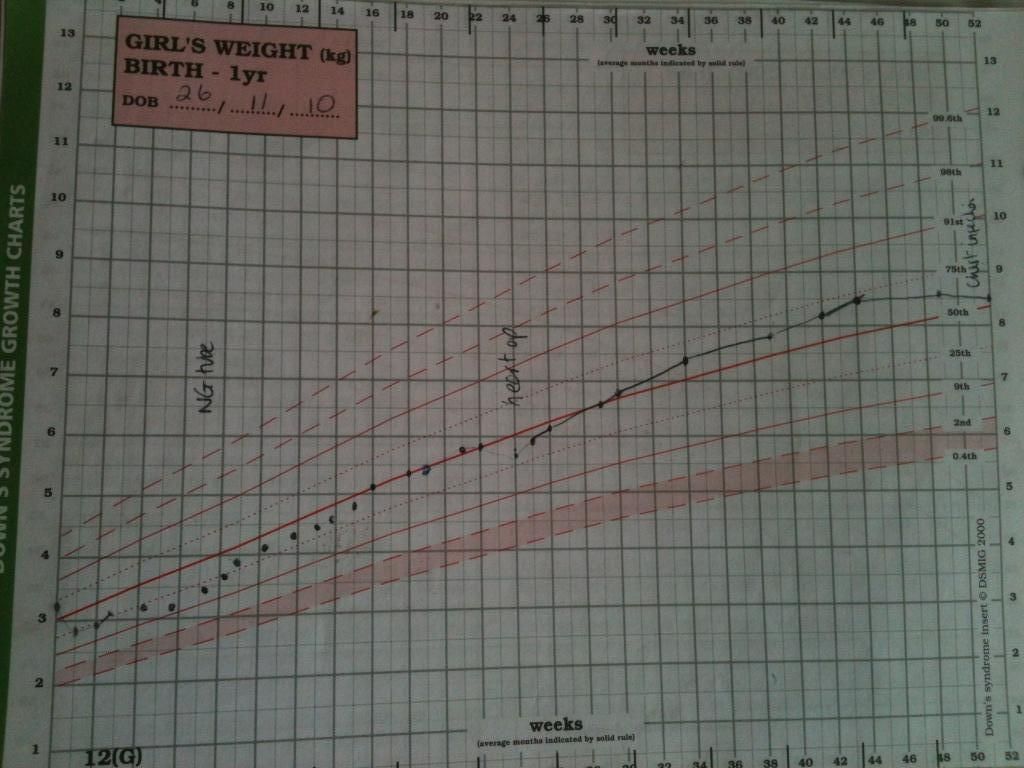 A Different View Ella's feeding story