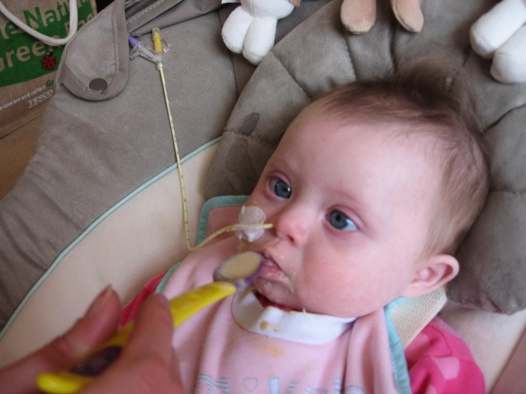 A Different View Ella�s feeding story